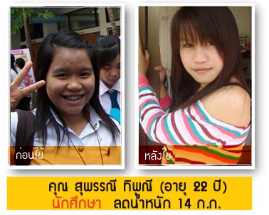 ลดน้ำหนัก 3-5 กก. ผ่านอย .สูตรนี้ผอมถาวร ปลอดภัย ผลลัพธ์ 100% ที่นี่...