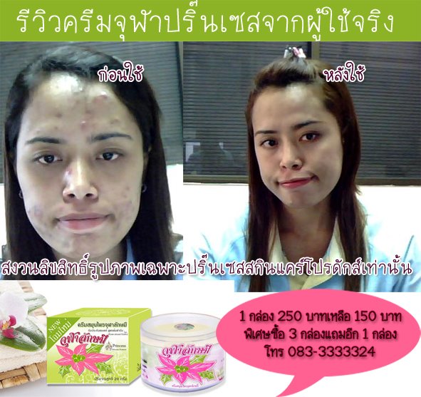 ขายปลีก-ขายส่ง ครีมหมอจุฬา(ครีมจุฬาลักษมี) ของแท้ หากพบว่าเป็นครีมจุฬาลักษมีของปลอม คืนเงินให้100เท่าค่ะ